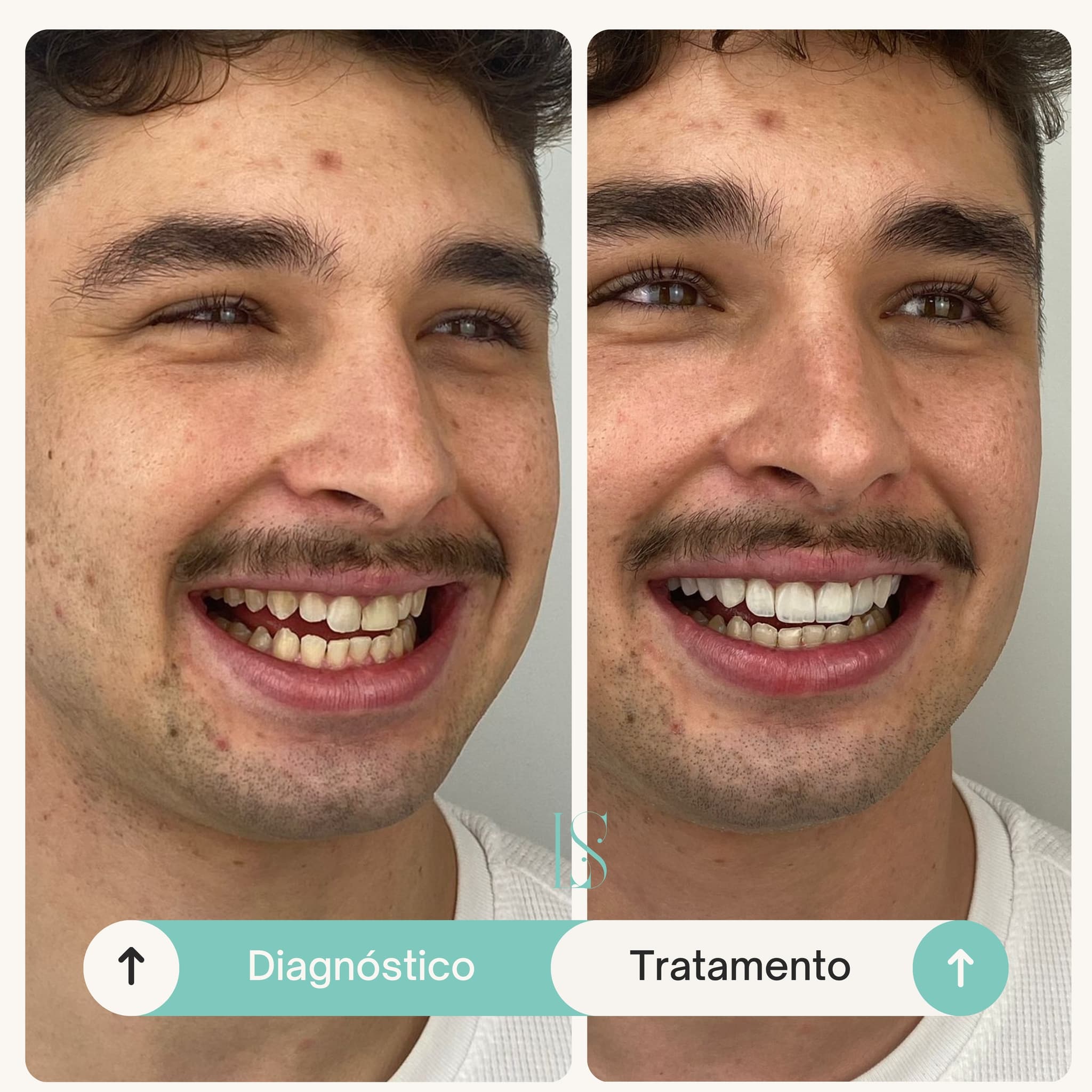Antes e depois de tratamento odontológico